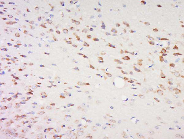 SPOCK2/Testican 2 Antibody in Immunohistochemistry (Paraffin) (IHC (P))