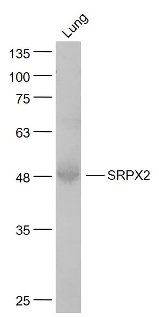 SRPX2 Antibody in Western Blot (WB)