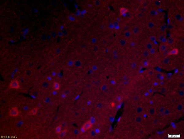 NOTCH1/activated Notch1 Antibody in Immunohistochemistry (Paraffin) (IHC (P))