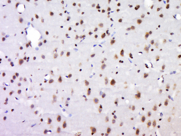 NECAB1/EF-CBP1 Antibody in Immunohistochemistry (Paraffin) (IHC (P))