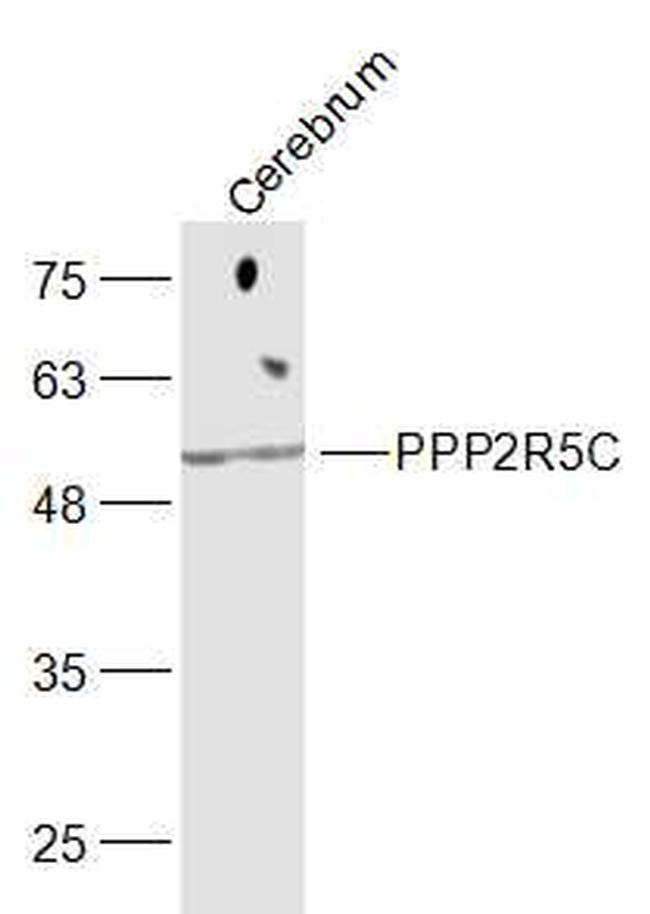 PPP2R5C Antibody in Western Blot (WB)
