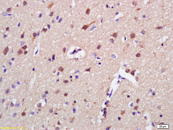 AKAP7 Antibody in Immunohistochemistry (Paraffin) (IHC (P))