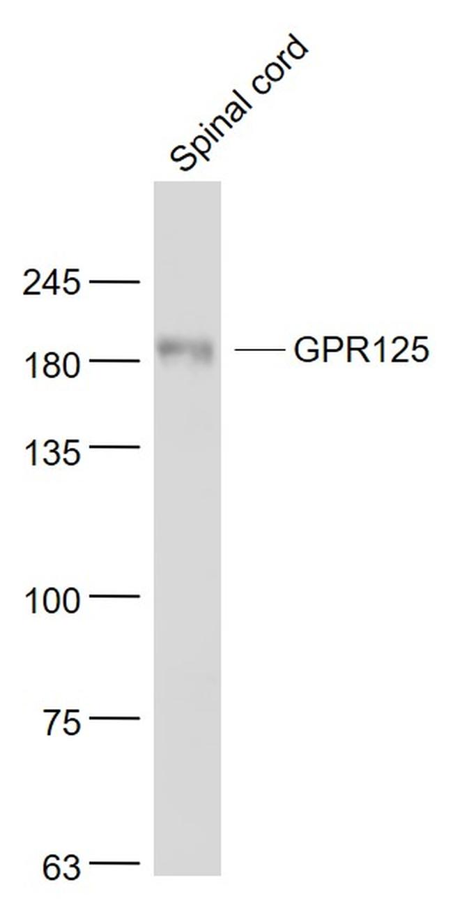 GPR125 Antibody in Western Blot (WB)