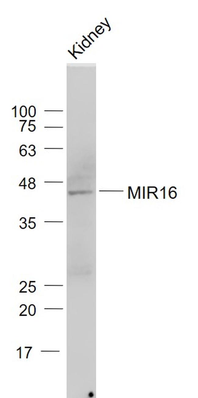 MIR16/GDE1 Antibody in Western Blot (WB)