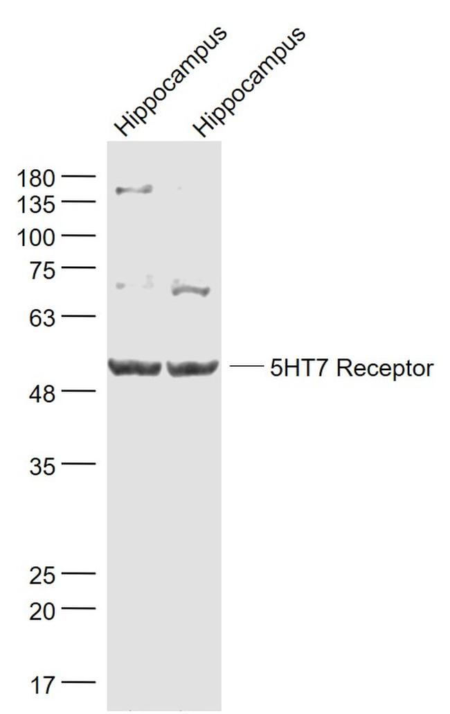 5HT7 Receptor/SR-7 Antibody in Western Blot (WB)