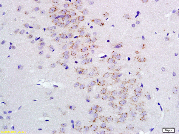 GABRA2/GABA A Receptor alpha 2 Antibody in Immunohistochemistry (Paraffin) (IHC (P))