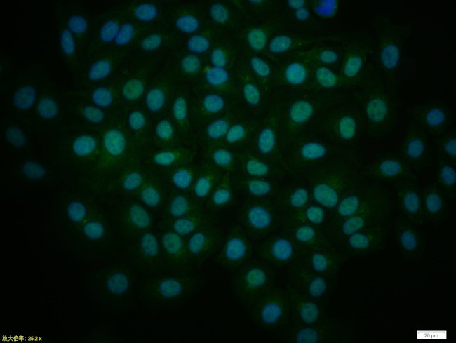 GLI1 Antibody in Immunocytochemistry (ICC/IF)