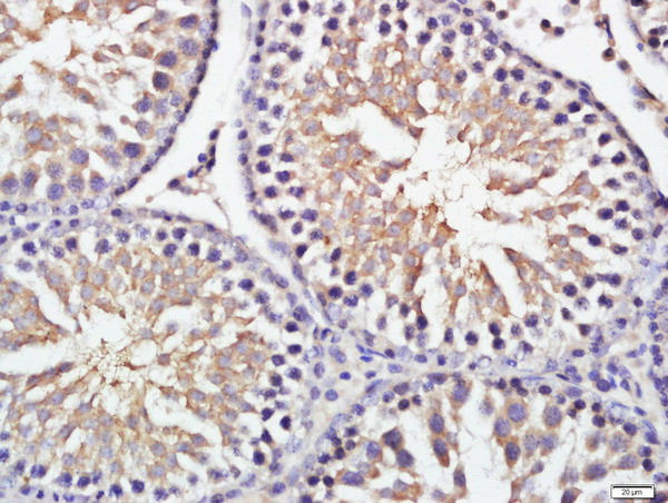 GRINA Antibody in Immunohistochemistry (Paraffin) (IHC (P))