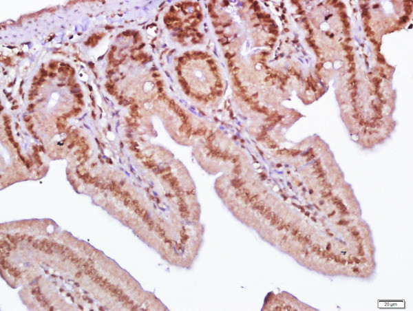SLC38A2/SNAT2 Antibody in Immunohistochemistry (Paraffin) (IHC (P))
