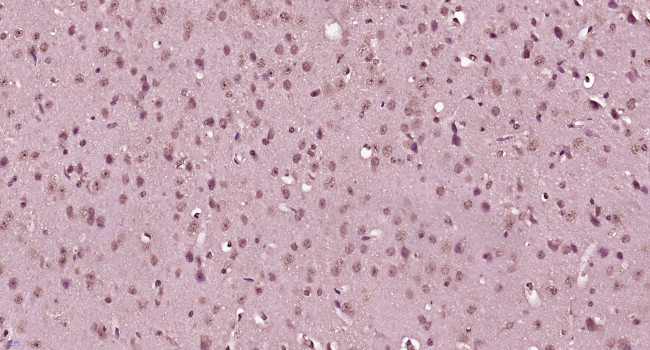 ACCN2 Antibody in Immunohistochemistry (Paraffin) (IHC (P))