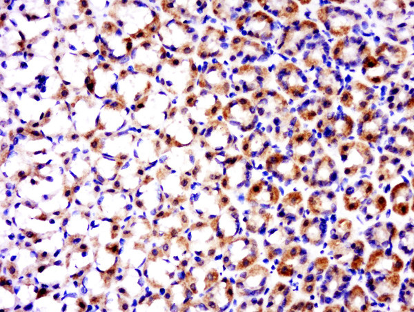 TRAF1 Antibody in Immunohistochemistry (Paraffin) (IHC (P))