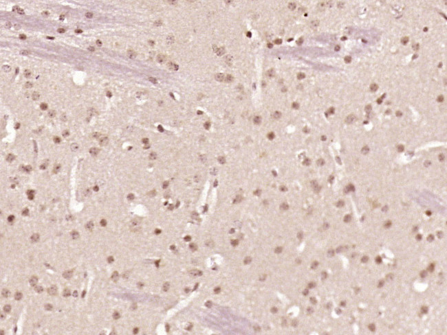 ZNF312 Antibody in Immunohistochemistry (Paraffin) (IHC (P))