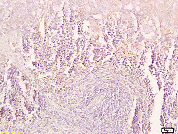TRAIL Antibody in Immunohistochemistry (Paraffin) (IHC (P))