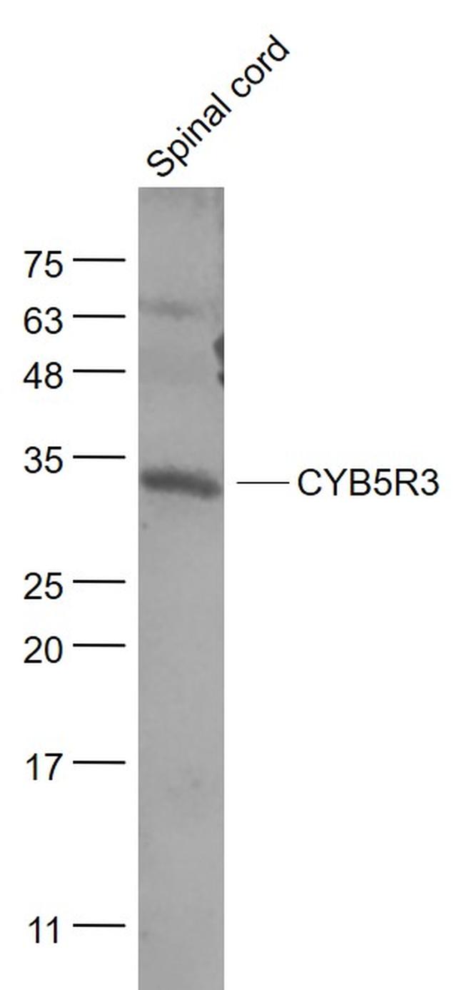 CYB5R3 Antibody in Western Blot (WB)
