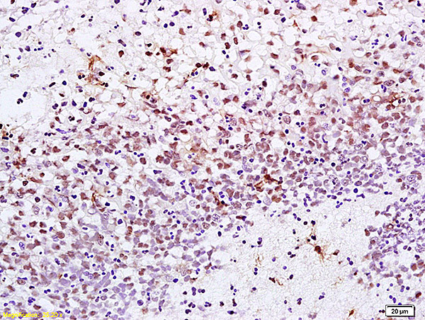 XRCC1 Antibody in Immunohistochemistry (Paraffin) (IHC (P))