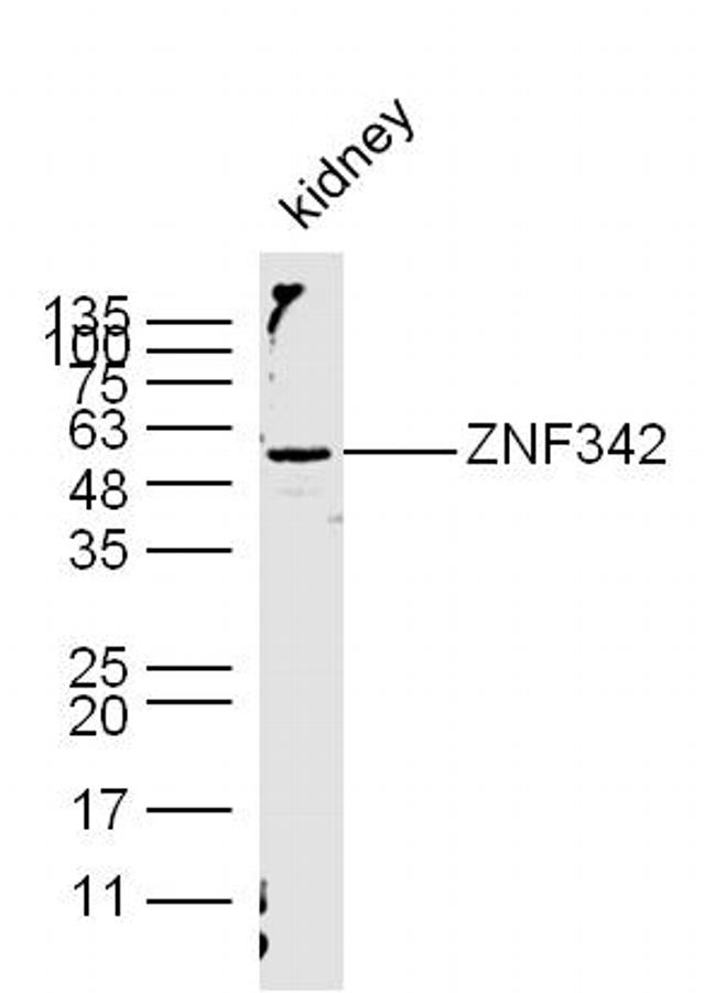 ZNF342/ZNF296 Antibody in Western Blot (WB)