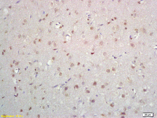 ZNF423/OAZ Antibody in Immunohistochemistry (Paraffin) (IHC (P))
