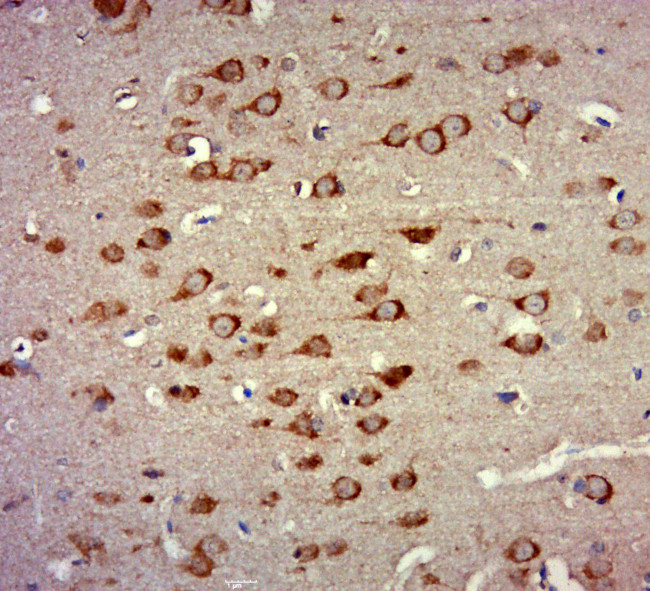 ZNF346 Antibody in Immunohistochemistry (Paraffin) (IHC (P))
