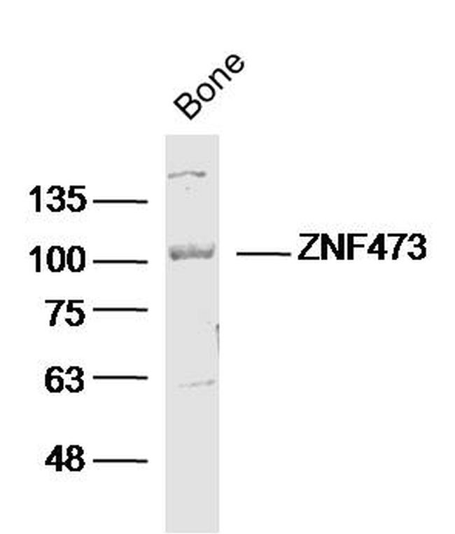 ZFP100/ZNF473 Antibody in Western Blot (WB)