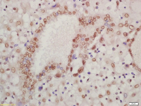 HOXA13 Antibody in Immunohistochemistry (Paraffin) (IHC (P))