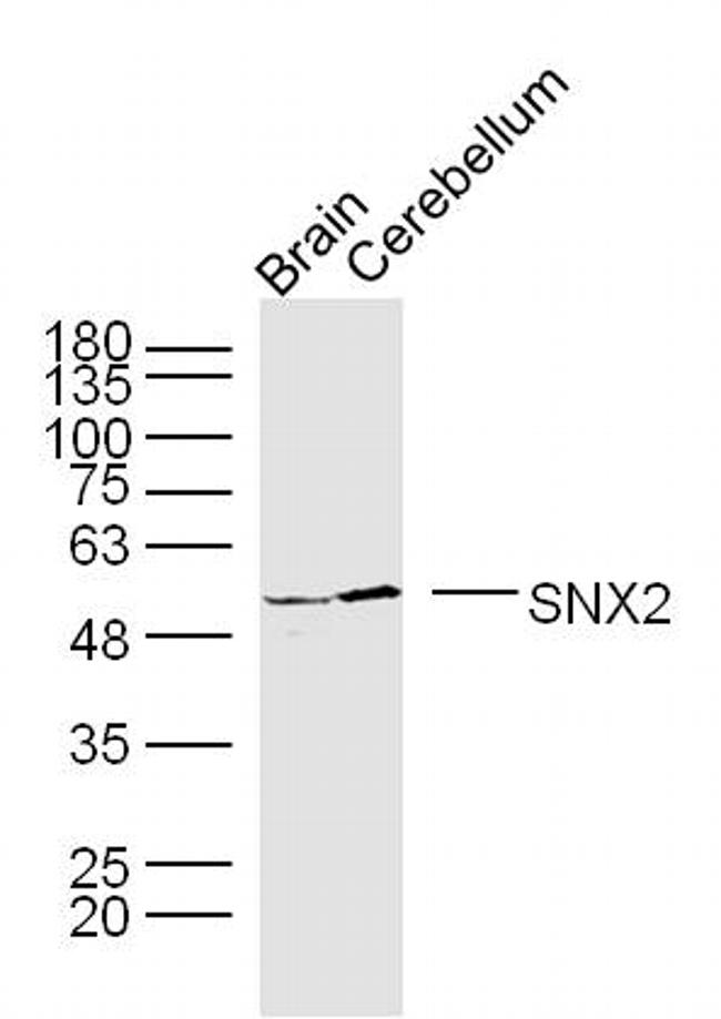 SNX2 Antibody in Western Blot (WB)