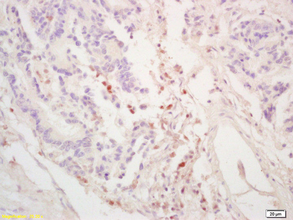 GGNBP2/ZNF403/LCRG1 Antibody in Immunohistochemistry (Paraffin) (IHC (P))