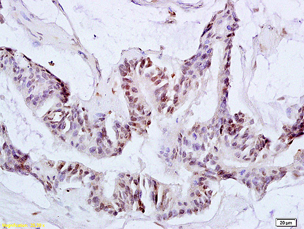 Ack1 Antibody in Immunohistochemistry (Paraffin) (IHC (P))