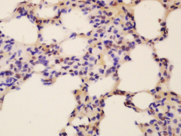 Fox2/RBM9 Antibody in Immunohistochemistry (Paraffin) (IHC (P))