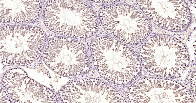 DYRK2 Antibody in Immunohistochemistry (Paraffin) (IHC (P))