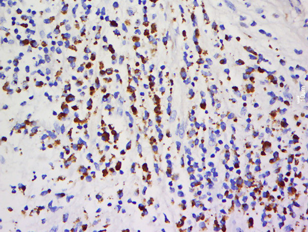SHP-2/PTPN11 Antibody in Immunohistochemistry (Paraffin) (IHC (P))