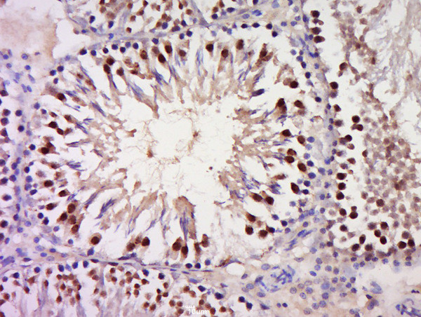 GSC Antibody in Immunohistochemistry (Paraffin) (IHC (P))