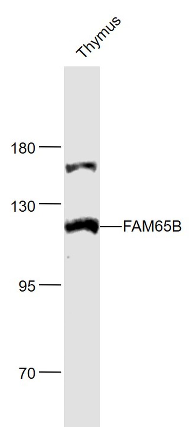 FAM65B Antibody in Western Blot (WB)