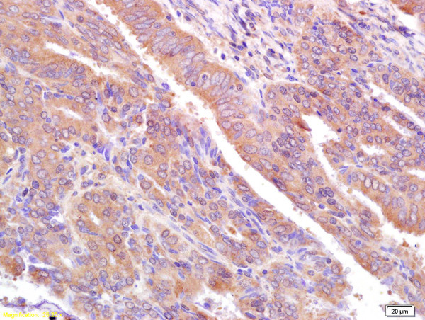 MUC1 Antibody in Immunohistochemistry (Paraffin) (IHC (P))