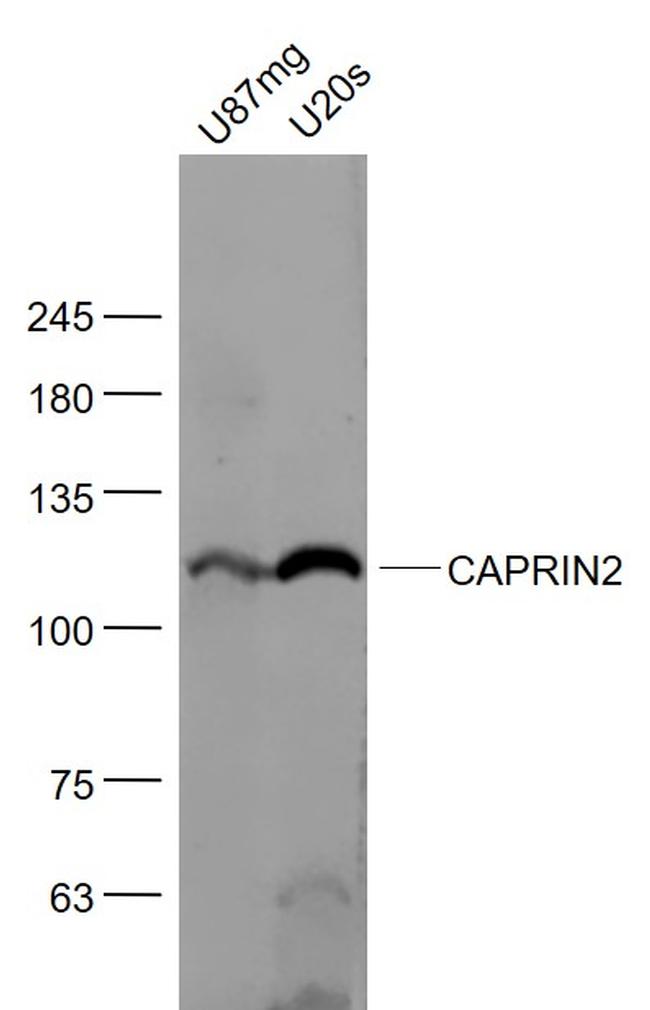 CAPRIN2 Antibody in Western Blot (WB)