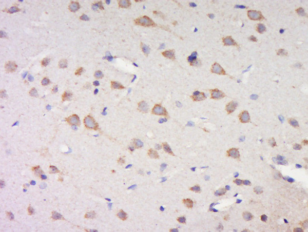 Phospho-Casein kinase 1 isoforms gamma 1/2/3 (Tyr263) Antibody in Immunohistochemistry (Paraffin) (IHC (P))