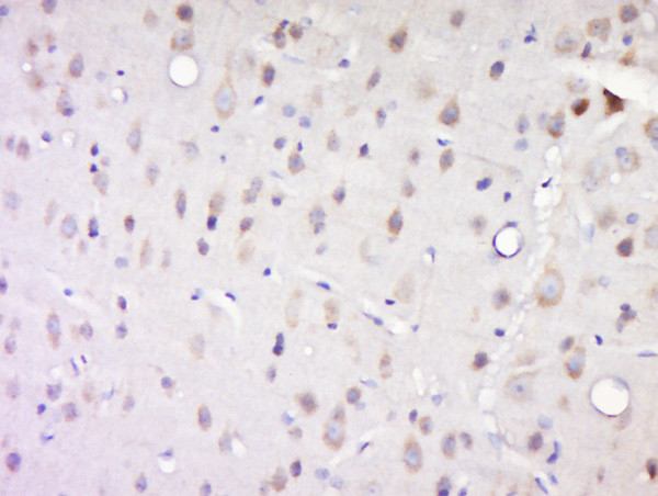 Phospho-Casein Kinase 1 alpha (Tyr294) Antibody in Immunohistochemistry (Paraffin) (IHC (P))