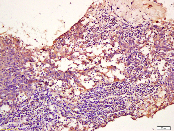 TPM2 Antibody in Immunohistochemistry (Paraffin) (IHC (P))