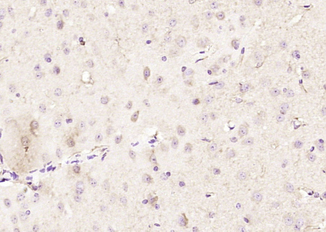 ADH5 Antibody in Immunohistochemistry (Paraffin) (IHC (P))