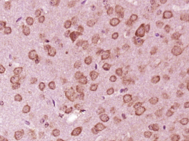 PLEKHG5 Antibody in Immunohistochemistry (Paraffin) (IHC (P))