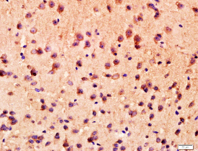 ANKK1 Antibody in Immunohistochemistry (Paraffin) (IHC (P))