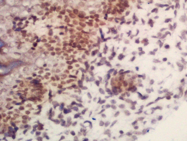 ARID1B Antibody in Immunohistochemistry (Paraffin) (IHC (P))