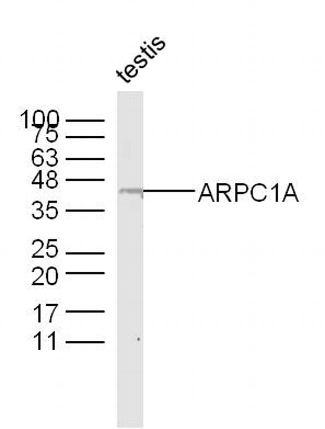 ARPC1A Antibody in Western Blot (WB)