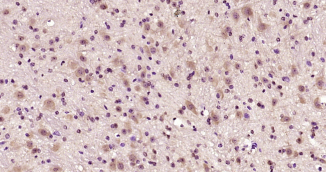 Phospho-Ataxin 1 (Ser775) Antibody in Immunohistochemistry (Paraffin) (IHC (P))