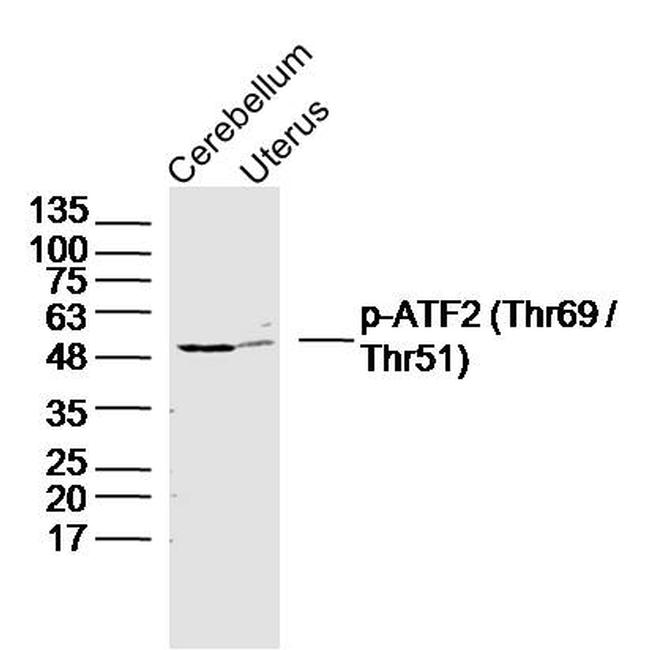 Phospho-ATF2 (Thr69) Antibody in Western Blot (WB)