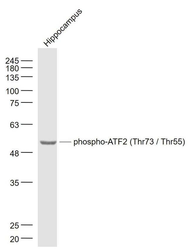 Phospho-ATF2 (Thr55) Antibody in Western Blot (WB)
