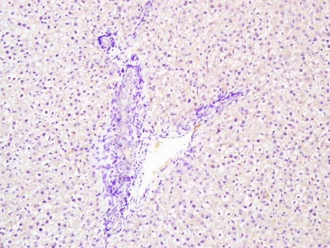 Phospho1 Antibody in Immunohistochemistry (Paraffin) (IHC (P))