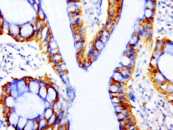 Phospho-beta Catenin (Ser33) Antibody in Immunohistochemistry (Paraffin) (IHC (P))