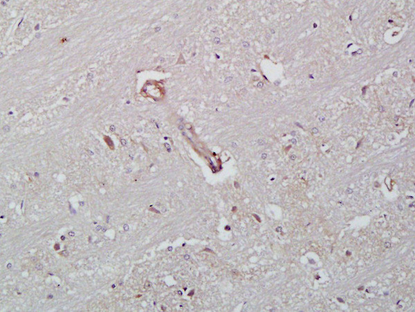 ICAM-2/CD102 Antibody in Immunohistochemistry (Paraffin) (IHC (P))