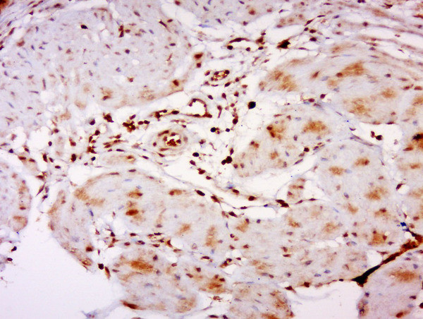 CRTR1 Antibody in Immunohistochemistry (Paraffin) (IHC (P))