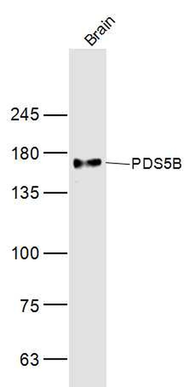 PDS5B Antibody in Western Blot (WB)
